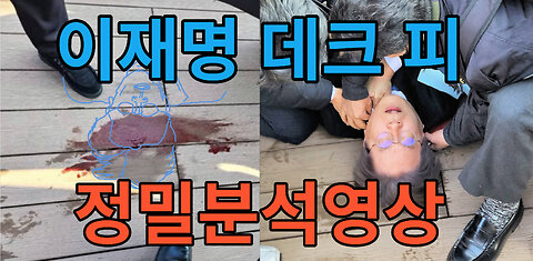 이재명 뒷목 할로윈피주머니(halloween blood bag) 데크(deck) 피 정밀분석영상공개!!!