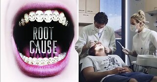 The Root Cause Documentary - How Oral Infections Cause Hidden Chronic Disease