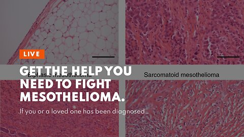 Get the Help You Need to Fight Mesothelioma.