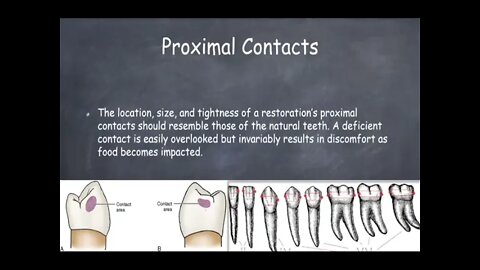 Operative L17 (Fixed Prosthodontics:Clinical Try-in & Cementation)