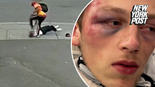 22 year-old visiting Seattle brutally beaten by stranger, video shows