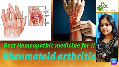 Rheumatoid arthritis कारण, लक्षण और इलाज #drminakshisingh