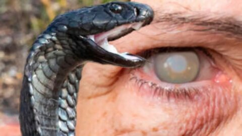 HOW TO SURVIVE A SPITTING COBRA ATTACK | Tech and Science |