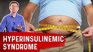 An Interesting Paper on Hyperinsulinemic Syndrome – Dr. Berg