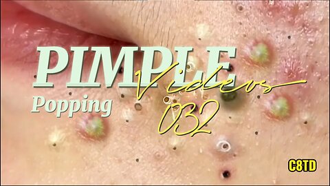 Satisfying Pimple Popping Videos 032