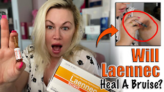 Will Laennec Heal a Bruise? Let's test! From AceCosm.com | Code Jessica10 Saves you Money!