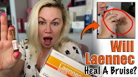 Will Laennec Heal a Bruise? Let's test! From AceCosm.com | Code Jessica10 Saves you Money!