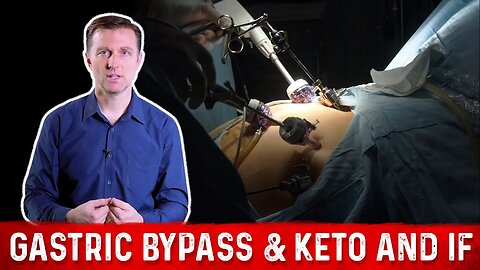 Gastric Bypass & Keto and Intermittent Fasting – Dr. Berg