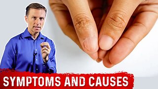 Iron Deficiency Symptoms and Causes of Anemia – Dr.Berg
