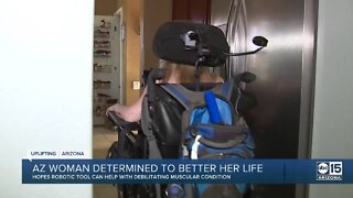 Valley woman seeks independence through robotic arm