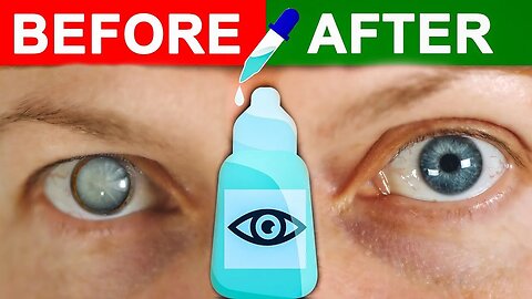 The #1 Remedy for Cataracts | True Facts