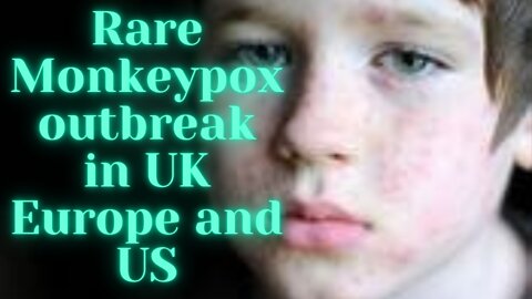 Rare monkeypox outbreak in UK, Europe, and US