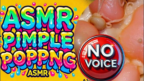 Mochi Pimple Popping no voice ASMR / Cat Paw🐾 / Men power 💪 #pimplepopping