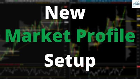 Day Trading Using Market Profile With A New Thinkorswim Setup.