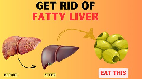 Top 7 Essential Vitamins To Detox Fatty Liver | Fatty Liver Treatment | Healthy Liver