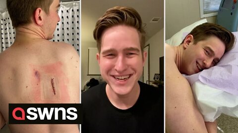 TikTok users saved man’s life by warning about cancerous mole seen in ONE SECOND CLIP