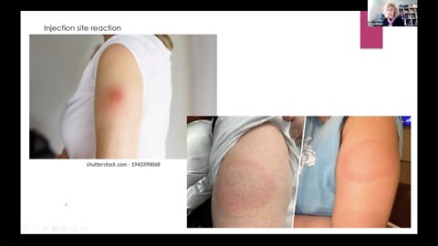 Dr. Emma Brierly - U.K. Physician’s Observations Skin Reactions Post Covid-19 Jab