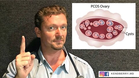 PCOS: Could it be Your DIET? (Fertility Update 2021)
