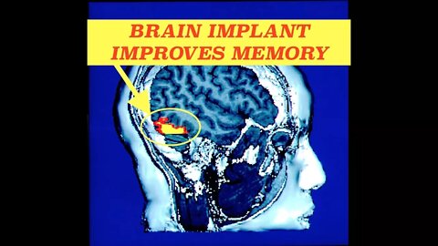 Microchips Now in Your Medicine - FDA Approves Tracking Pills & New Brain Implants Increase Memory