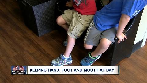 What to do if your kid comes home with hand, foot & mouth disease