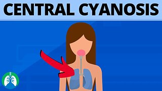 Central Cyanosis (Medical Definition) | Quick Explainer Video