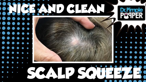 A Nice and Clean Cut Scalp