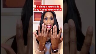 4 Things Your Nails 💅🏼 Say About Your Health! #shorts