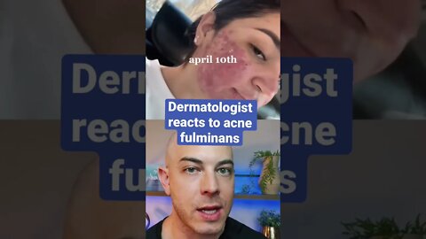 Derm reacts to crazy acne fulminans!