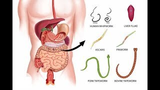 Weight Loss Mini-Course Part - 8: Unlock the Hidden Link Between Parasites and Weight Gain