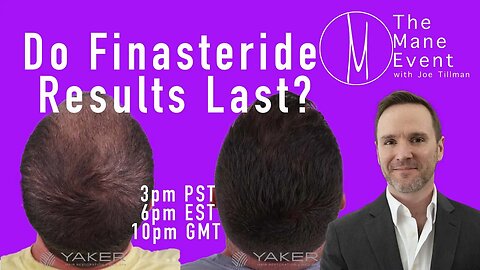 Do Finasteride Results Last? The Mane Event - Tuesday, August 22nd