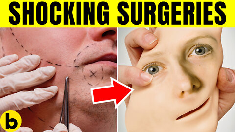 5 Unique Surgical Procedures To Be Ever Done
