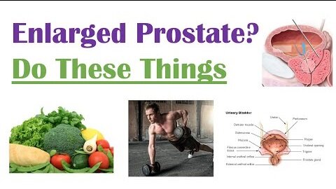 What to Do and Not Do with Enlarged Prostate | Lifestyle Modifications