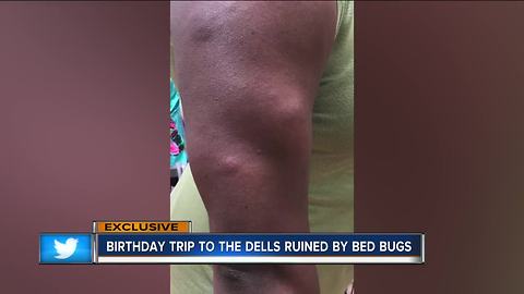 Group from Milwaukee bitten by bedbugs at Wisconsin Dells resort