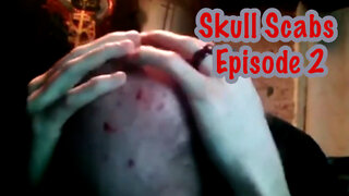 Cyrax - Skull Scabs Episode 2