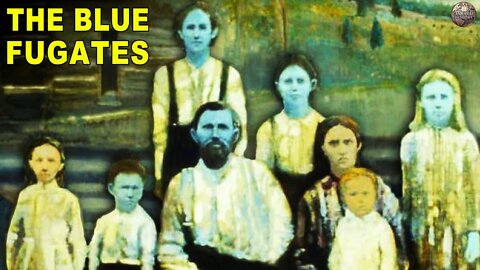 The Blue People (Blue bloods and blue babies)