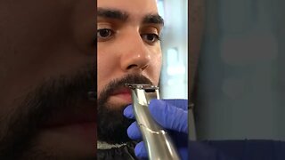 Beard Timelapse