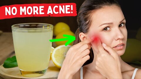 Drinking This Juice Daily Can Rid Your Skin of Pimples and Blemishes