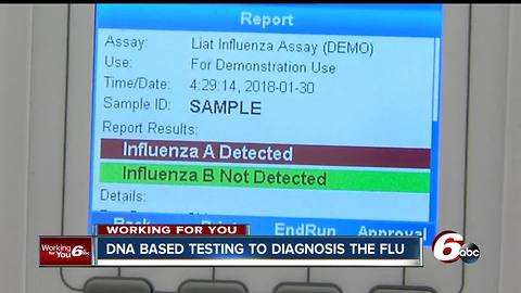 DNA-based testing on the horizon to help diagnose the flu