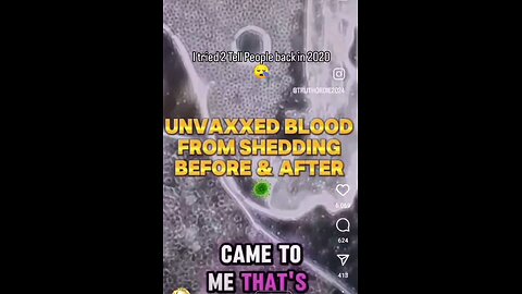 How to Cure Unvaxxed from Vaccination Shedding! MUST WATCH