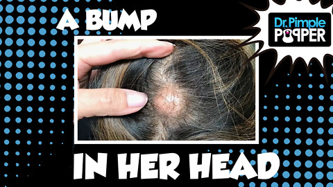 The Bump in Her Head...