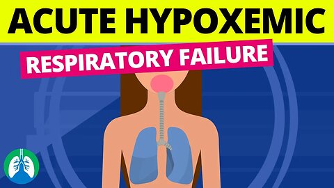 Acute Hypoxemic Respiratory Failure (Medical Definition)
