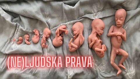 "Doktor akušerstva i ginekologije svjedoči o pravu izbora na abortus"