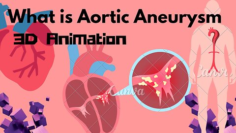 Human Body " what is Aortic Aneurysm " 3D Animated video