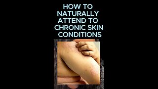 How to remedy chronic skin conditions