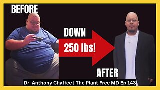 🔴He Only Ate Meat For 1 Year and This Is What Happened! Carnivore Diet