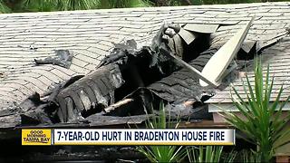 Bradenton house fire kills dog, sends deaf child to hospital with severe burns