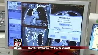 New test diagnoses pancreatic cancer