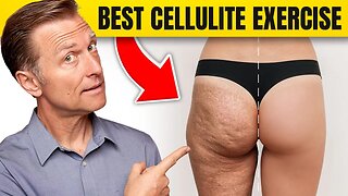 The Best Workout for Cellulite: Dr. Berg's Expert Advice