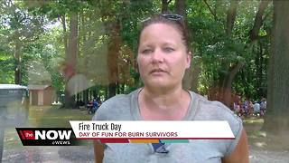 Burn survivors get a day of fun with firefighters