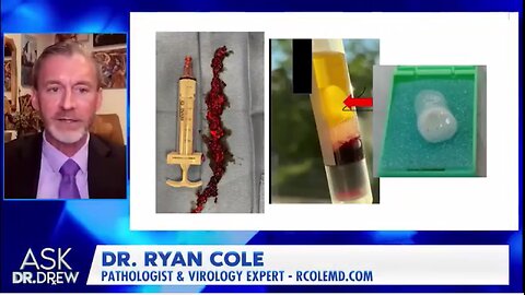 "Foot-Long Blood Clots" From mRNA, Says Pathologist Dr. Ryan Cole | Ask Dr. Drew